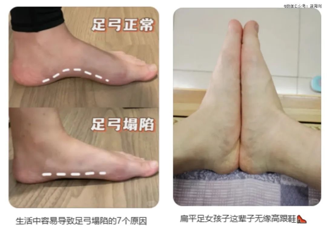 休闲鞋品牌年轻人捧红日本“足力健”王铁梅也在穿