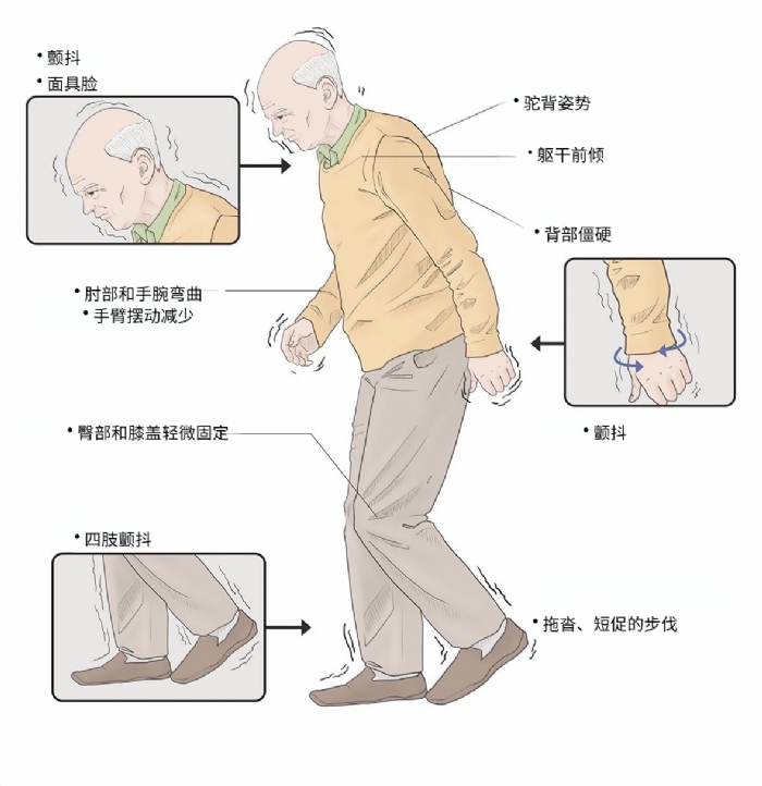 通用细胞治疗帕金森病药企「士泽生物」完成5亿元C/C+轮融资